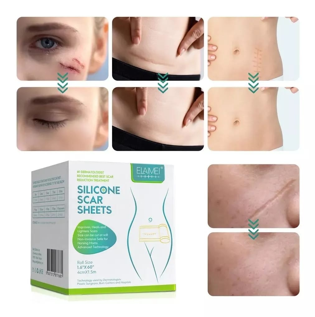 Cinta De Silicona Para Cicatrices